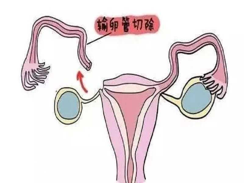 内蒙机构代孕产子，试管代孕助孕机构排名如何